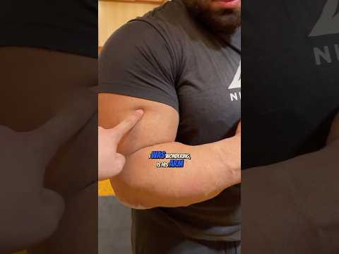 Pro Arm Wrestling Champion’s Arm Is Bigger Than My Head