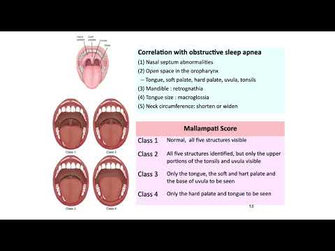 呼吸疾病學20230503 sleep apnea syndrome