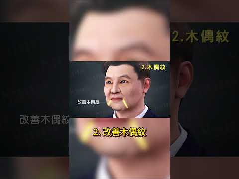 #法令紋 #木偶紋 #嘴邊肉下垂 OUT！ #蘋果肌提升 #緊實輪廓線  多效合一 #三層次 #拉皮 一次還原少女顏