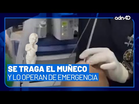 Sujeto es operado tras tragarse un muñeco de la Rosca de Reyes