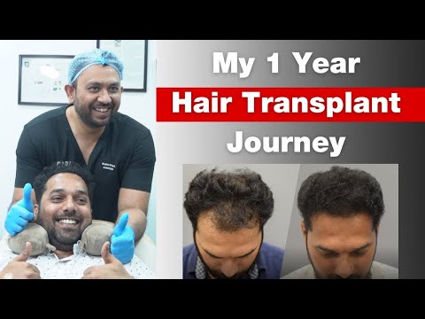 Best Cost of Hair Transplant in Mumbai: Do your research! #hairtransplantcost