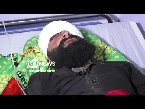 Survivor recounts deadly Pakistani airstrikes on Afghanistan| روایت بازمانده حملات پاکستان بر پکتیکا