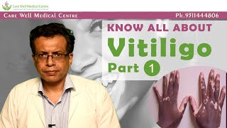 Vitiligo  Role of Diet in it - Is it Curable ?  Is it Transmitted to Children ?|  Dr.Sandeep Bhasin