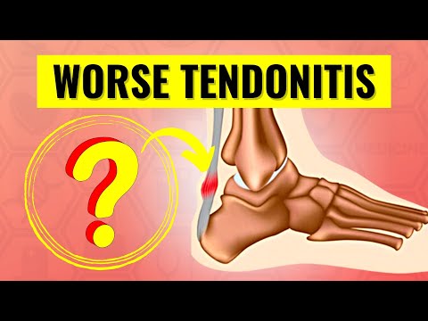 This is Proven to Cause And Worsen Tendonitis