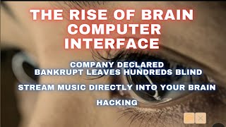 The Rise of Brain Computer interface: Bankrupt company leaves hundreds blind