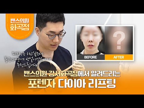 [밴스의원 강서화곡점]리프팅은 하고 싶은데 통증 때문에 망설이신다면?🫣 포텐자 다이아 리프팅을 소개해요📢