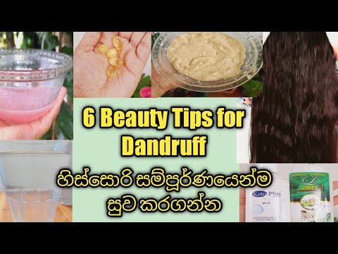 How to treat dandruff at home /Homemade natural treatment for dandruff /6 Beauty tips for dandruff