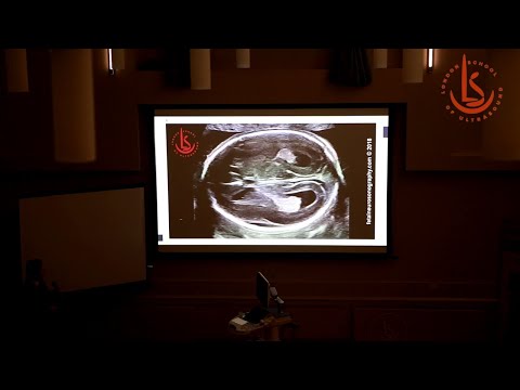 Fetal Neurosonography 2020 by London School of Ultrasound: Video Report