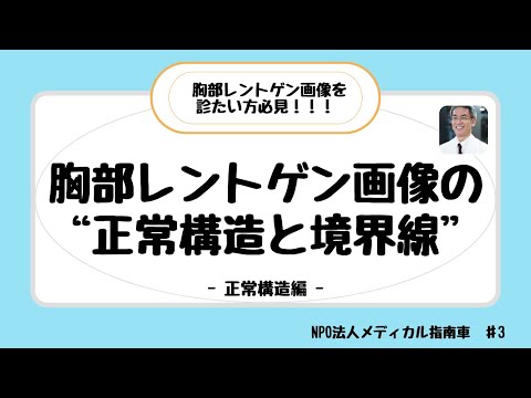 胸部レントゲン画像の正常構造と境界線 ー 正常構造編 ー