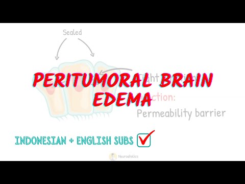 Peritumoral brain edema | a type of vasogenic cerebral edema | Neuroaholics