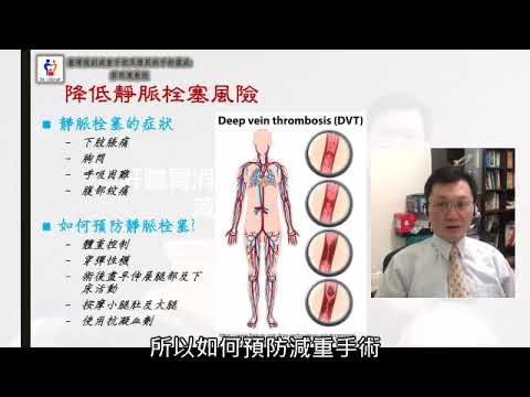 20181005 提高減重手術安全性:避免靜脈血栓形成 台灣減重手術權威蔡明憲教授解說版