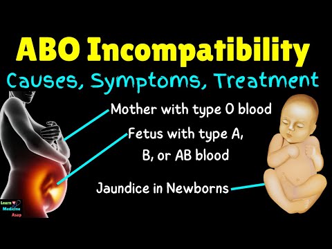 ABO Incompatibility in Newborns | ABO Incompatibility in Pregnancy – Causes, Symptoms & Treatments