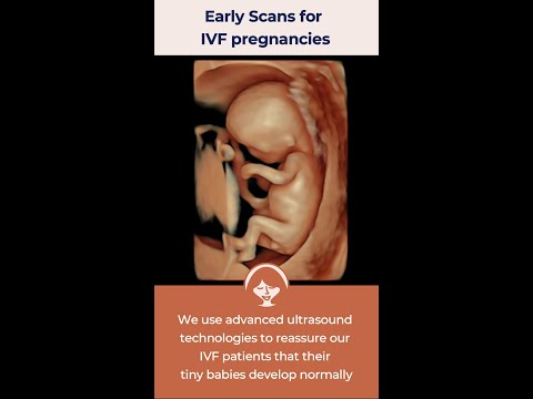 Early scans specially designed for IVF pregnancies