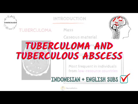 Tuberculoma vs Tuberculous Abscess: Symptoms, Diagnosis, and Treatment