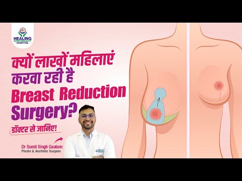 Breast Reduction Surgery Detailed Explanation | Cost, Risk, and Benefits