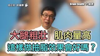 60歲邱醫跟你說：大腿粗壯、肌肉量很高，這樣抽脂效果好嗎？