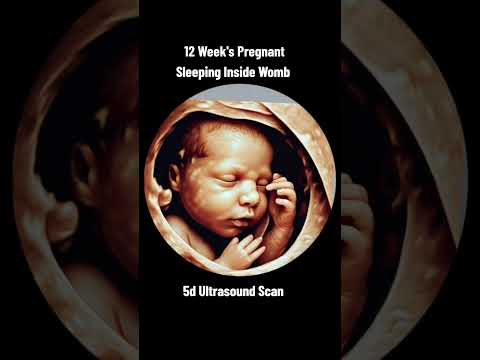 12 Week's Pregnant baby sleeping inside Womb #5dultrasound #ultrasoundscans