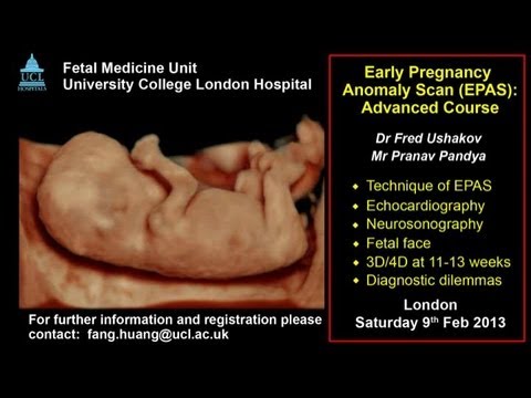 Early Pregnancy Anomaly Scan at 11-13 weeks: ISUOG Approved Course