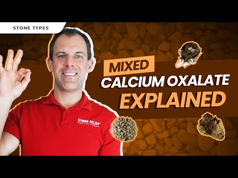 MIXED Calcium Oxalate Stones Explained