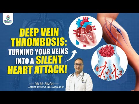 शरीर में खून के थक्के यानी Blood Clotting | समाधान | What is Pulmonary Embolism and DVT