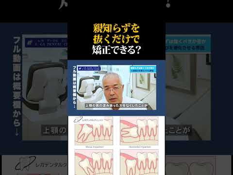 【#歯科医 が語る】親知らずを抜くだけで矯正できる事があるって本当？