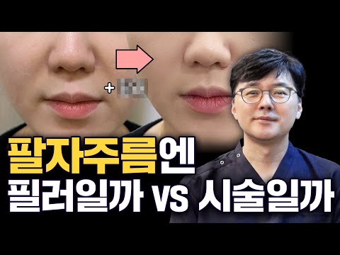 팔자주름엔 필러를 받아야 할까 시술을 해야 할까_ 모즈의원- 손승용