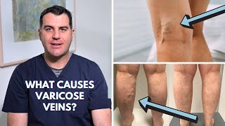 What causes varicose veins? Dr Peter Paraskevas explains.