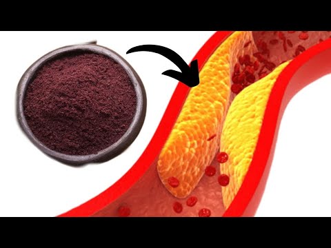 The Best Natural Remedy to Clear Out Your Arteries : Take 1 Spoon Daily!