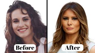 Melania Trump NEW LOOK | Plastic Surgery Analysis