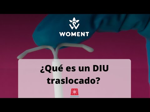 ¿Qué es un DIU traslocado? 🚨