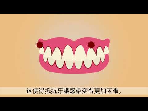 香烟的危害 (國語)