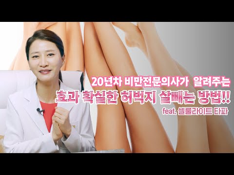 20년차 비만전문의사가 알려주는 허벅지 살빼는 방법!한 번 셀룰라이트를 타파해봅시다!