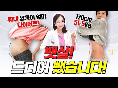 가장 현실적인 뱃살 빨리 없애는 방법💡#뱃살 저도 드디어 뺐습니다❗ #다이어트식단 #뱃살빼는법 #단기간다이어트