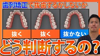 【歯科矯正】抜歯するかしないかってどうやって決めてるの？【歯医者が解説】