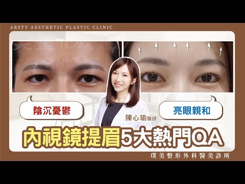 提眉疑問多？精選內視鏡提眉5大熱門QA醫師來解答！ #內視鏡提眉 #陳心瑜醫師