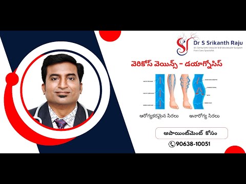 వెరికోస్ వెయిన్స్ - డయాగ్నోసిస్ | డా.శ్రీకాంత్ రాజు | వాస్కులర్ సర్జన్ |  హైదరాబాద్