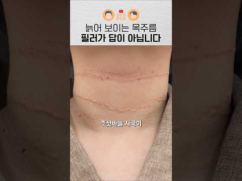 목주름 없애기 좋은 계절?｜가로 주름 관리, 피부과 시술