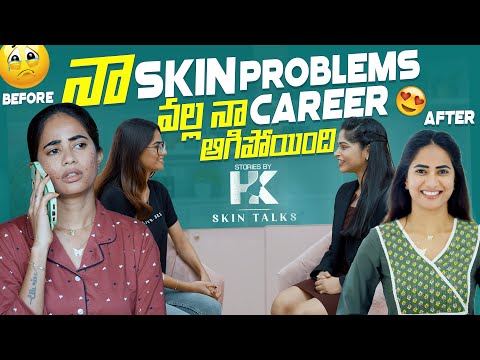 Na Skin problems vala na career agipoyndi 😔 | Harshithakarthik | HK Skin talks ❤️