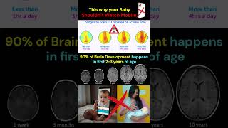 😡WARNING: 🧠Babies brain Affected by Mobile Screen