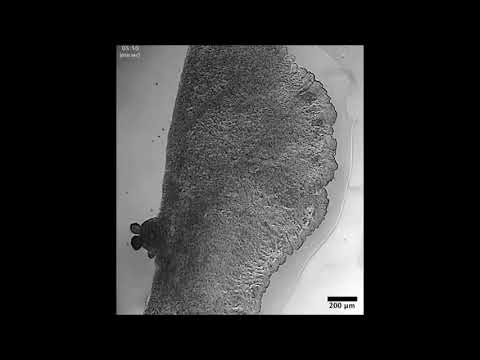 A lumped parameter model of endoplasm flow in Physarum polycephalum explains migration