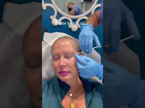 Botox Touch-Up with Dr. Dahabra: What You Need to Know! #shorts