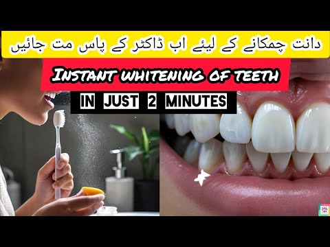 Instant Teeth Whitening| Teeth whitening |How to Whiten teeth instantly |How to Whiten teeth #howto