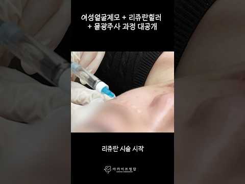 아카이브 여자제모&리쥬란힐러&물광주사 시술💉ㅣ스킨부스터 시술 시 통증을 최소화하는 방법은? #shorts