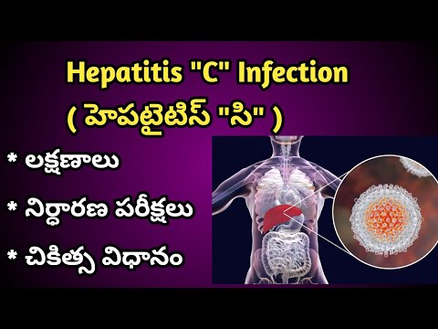 Hepatitis C Infection Causes, Symptoms and treatment in Telugu | హెపటైటిస్ " సి " లక్షణాలు, చికిత్స