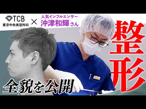 【整形】邪魔な頬肉を抹消する方法！元俳優の沖津和輝さんが試した結果…!