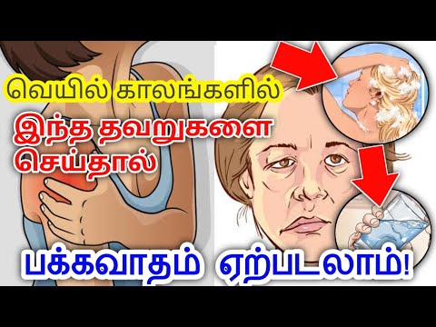 கோடைகாலங்களில் ஒருபோதும் இந்த தவறுகளை செய்யாதீர்கள் | Never do these mistakes in summer time