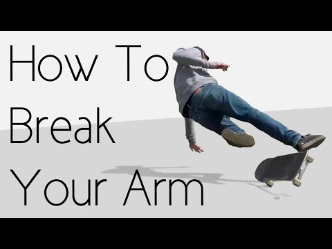 How To Break Your Arm The Easiest Way