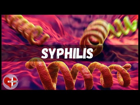 What is Syphilis? | Syphilis treatment, causes and symptoms Made Astoundingly Easy