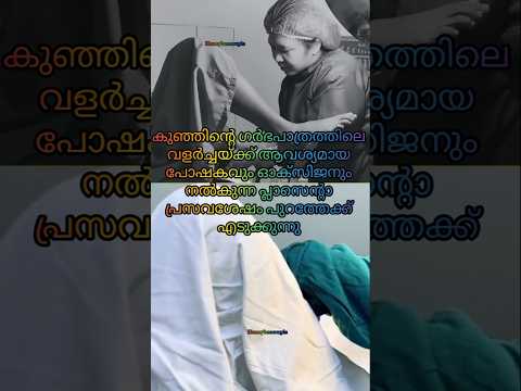 Placenta Removing🤰പ്ലസ്ന്റാ പുറത്തേക്ക് എടുക്കുമ്പോൾ 🤰🤰#youtubeshorts #postpartum #shorts #pregnancy