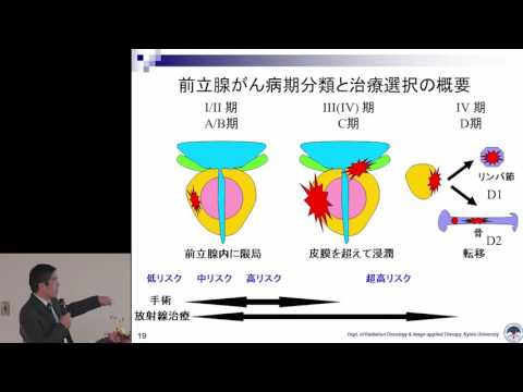 前立腺がんに対する放射線外部照射療法の最前線　溝脇 尚志 氏